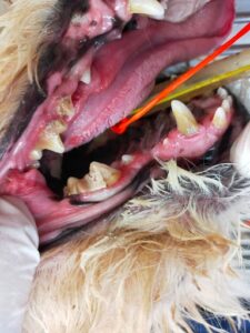 処置前_2025年9月 スケーリング(歯石除去)症例